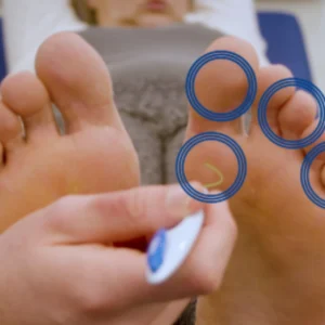 Diabetic Foot Checks